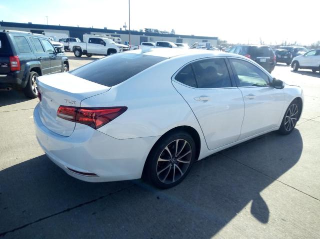 39516114-2015-acura-tlx_4