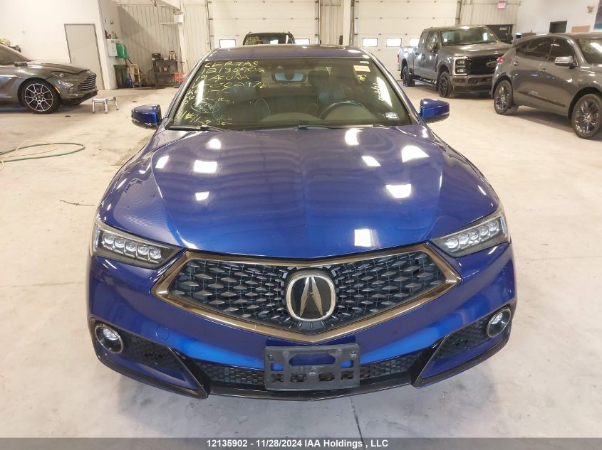 i2490202-2019-acura-tlx_11