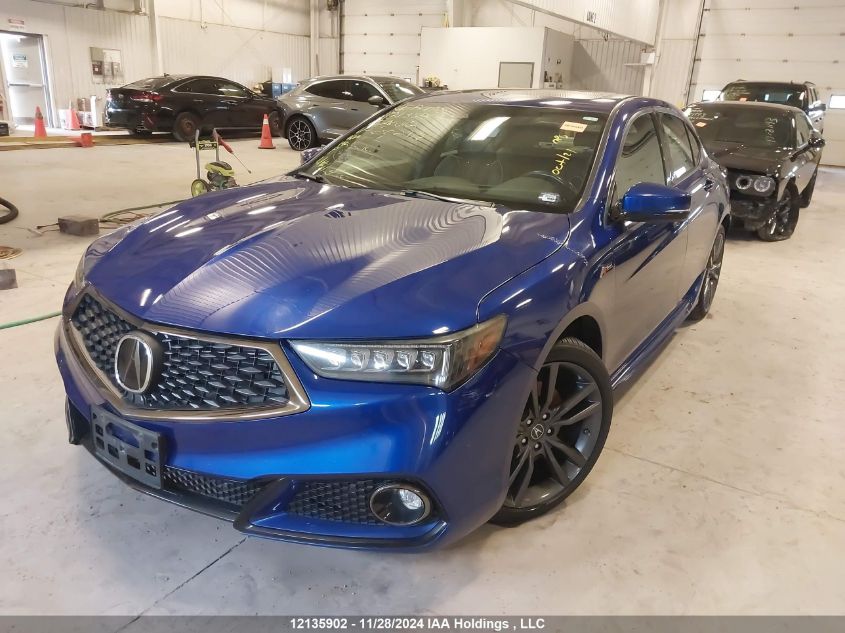 i2490202-2019-acura-tlx_2