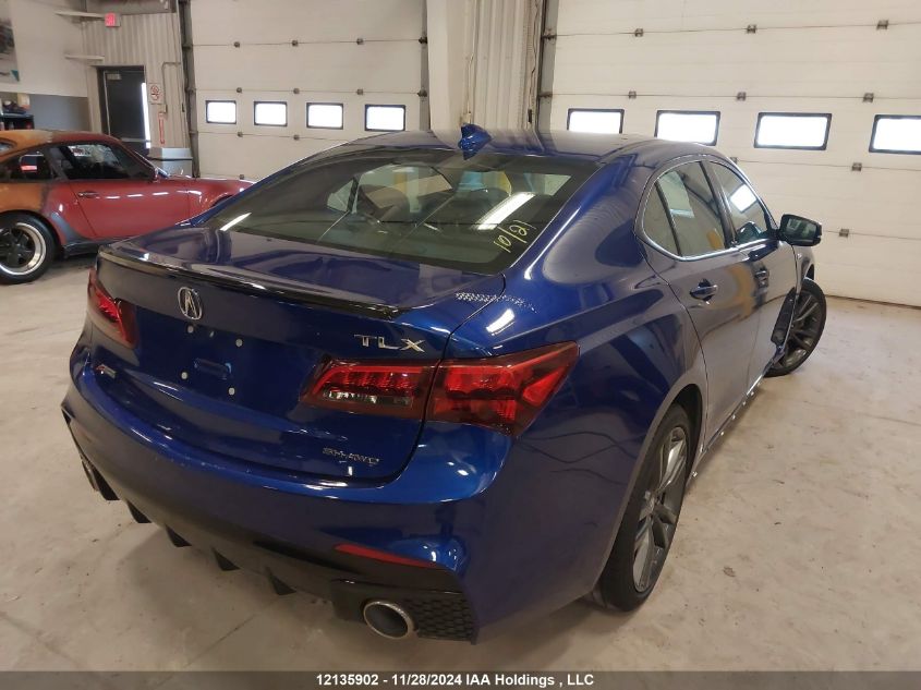 i2490202-2019-acura-tlx_4