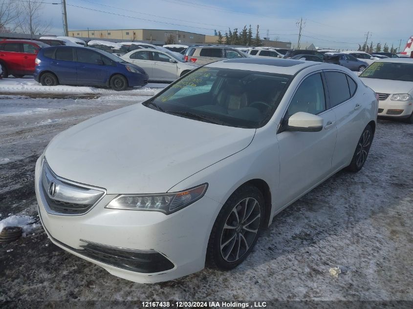 i2524417-2015-acura-tlx_2