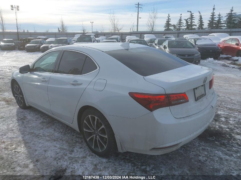 i2524417-2015-acura-tlx_3