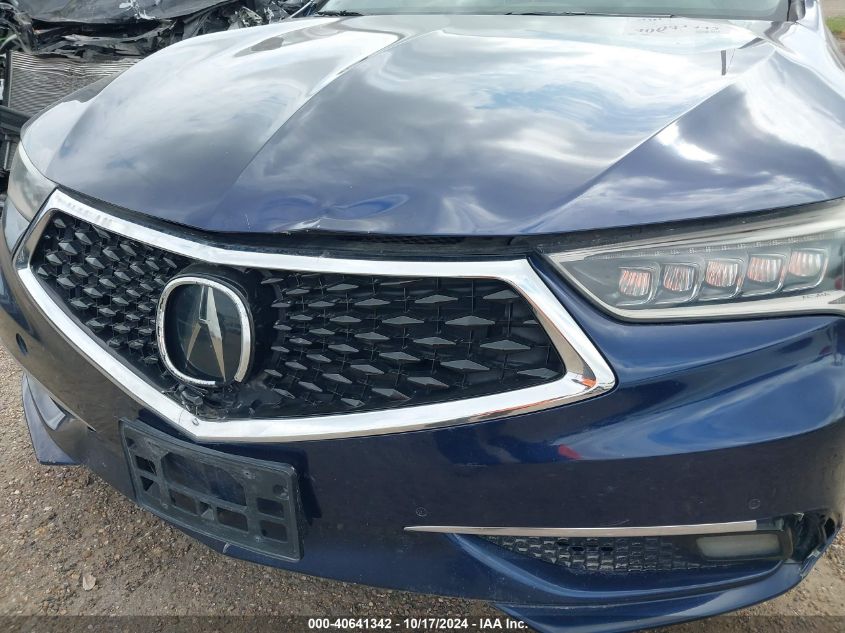 i41130487-2018-acura-tlx_6